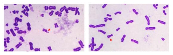 Chromosomal aberrations