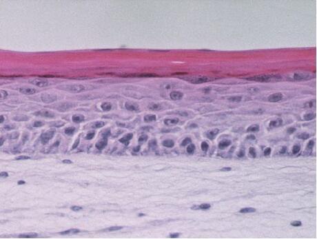 In vitro Full Thickness Skin Model