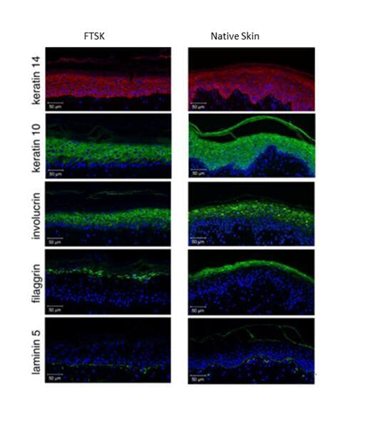 In vitro Full Thickness Skin Model