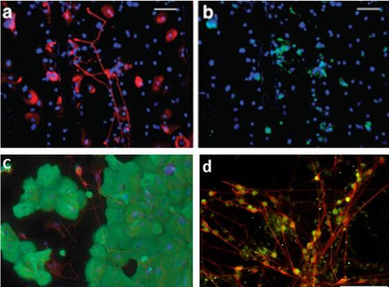 In vitro Neurodermatology Cell model