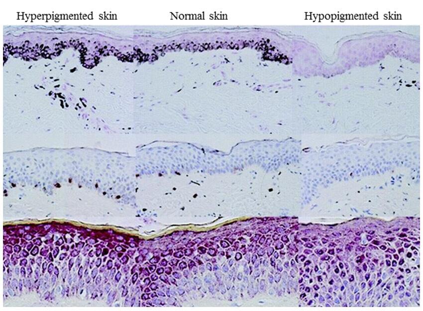  In vitro Pigmented skin Model