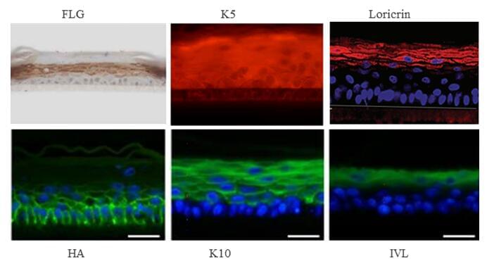 In vitro Reconstructed Human Epidermis (RHE)