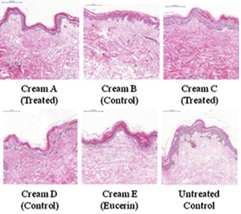 Ex vivo Skin explants