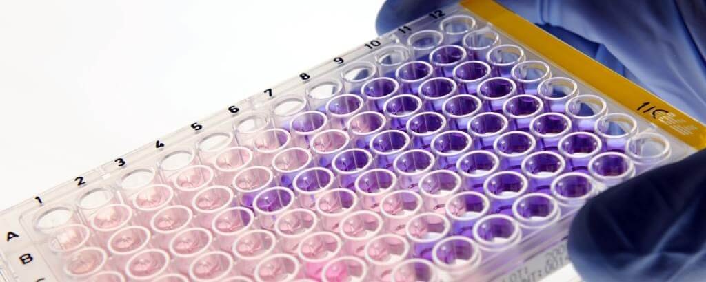 Sulforhodamine B (SRB) Assay