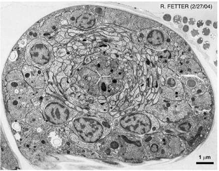 Transmission electron microscope