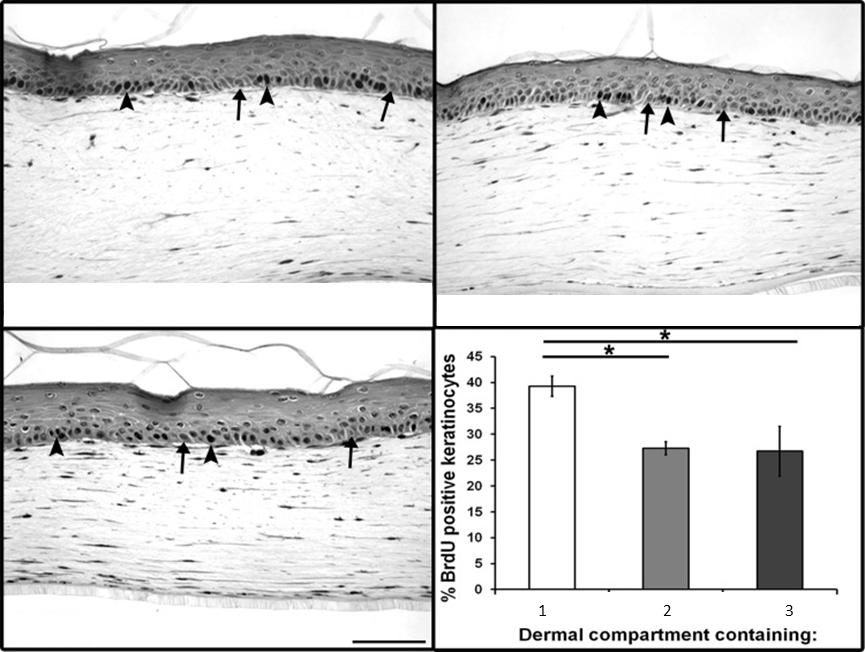 Increased basal keratinocyte proliferation in 3D FTSK model