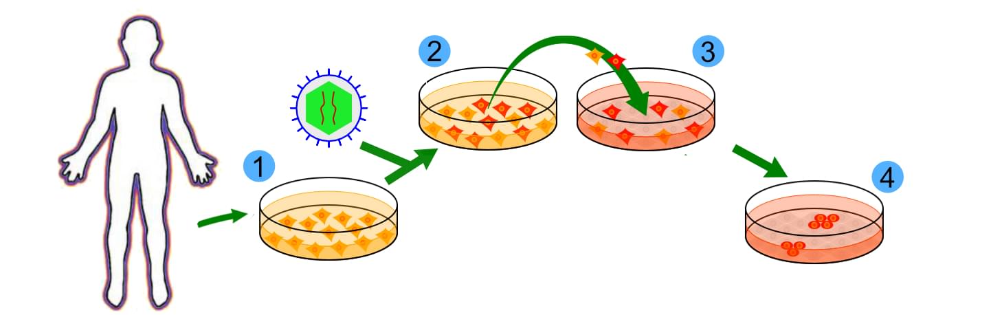 iPS Cell Research