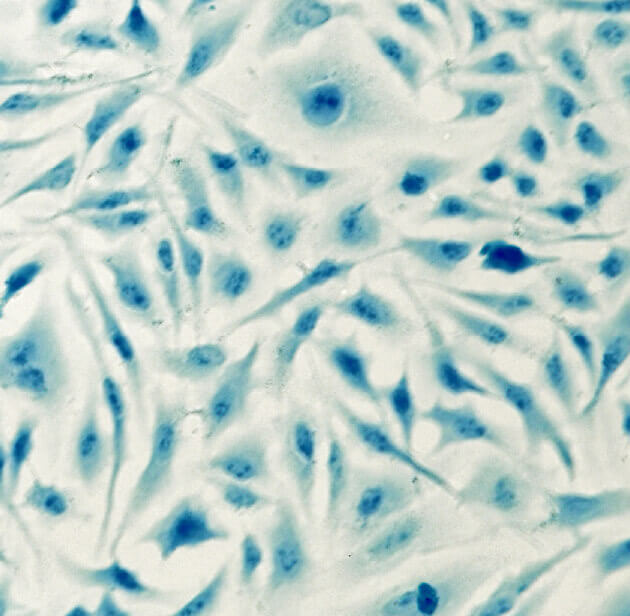 Immortalized Cells