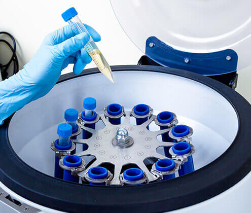 Exosome Research Services