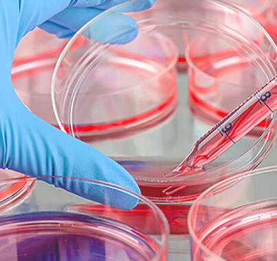 Human Alveolar Epithelial Cells