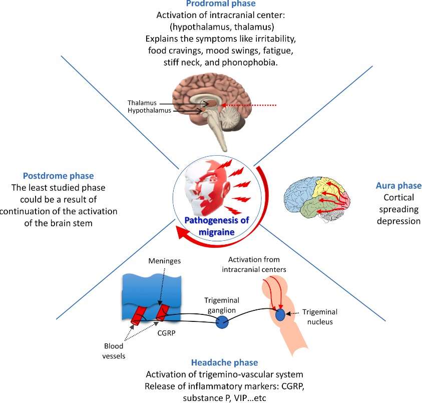 Diagram illustrating the mechanisms of various phases of migraine