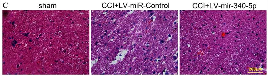 Diagram of the results from hematoxylin and eosin (H&E) staining used to assess the inflammatory response in nerve fibers.