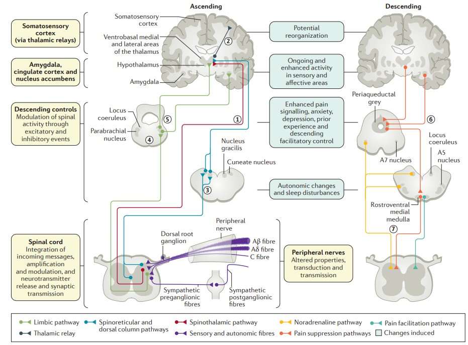 Visual representation showcasing the alterations in both peripheral and central systems resulting from nerve damage or the development of peripheral neuropathy.