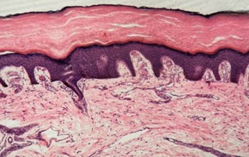 Skin Sectioning