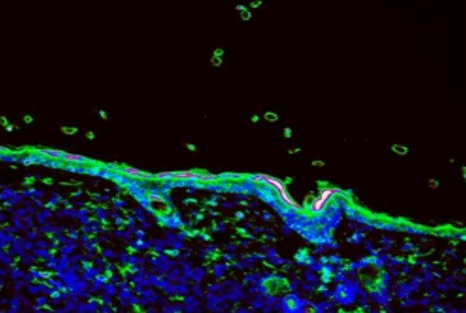 IHC Protocol of SABC and SV Methods