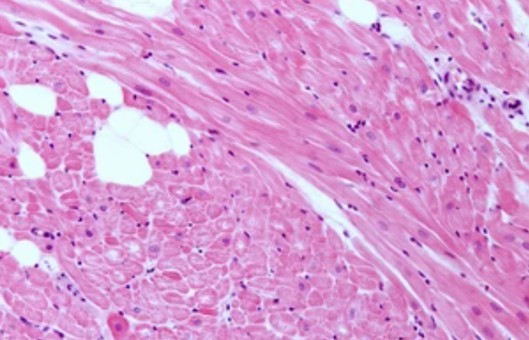 Cardiac Cells