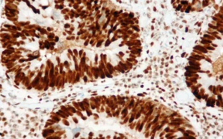 Immunocytochemistry (ICC) Protocol