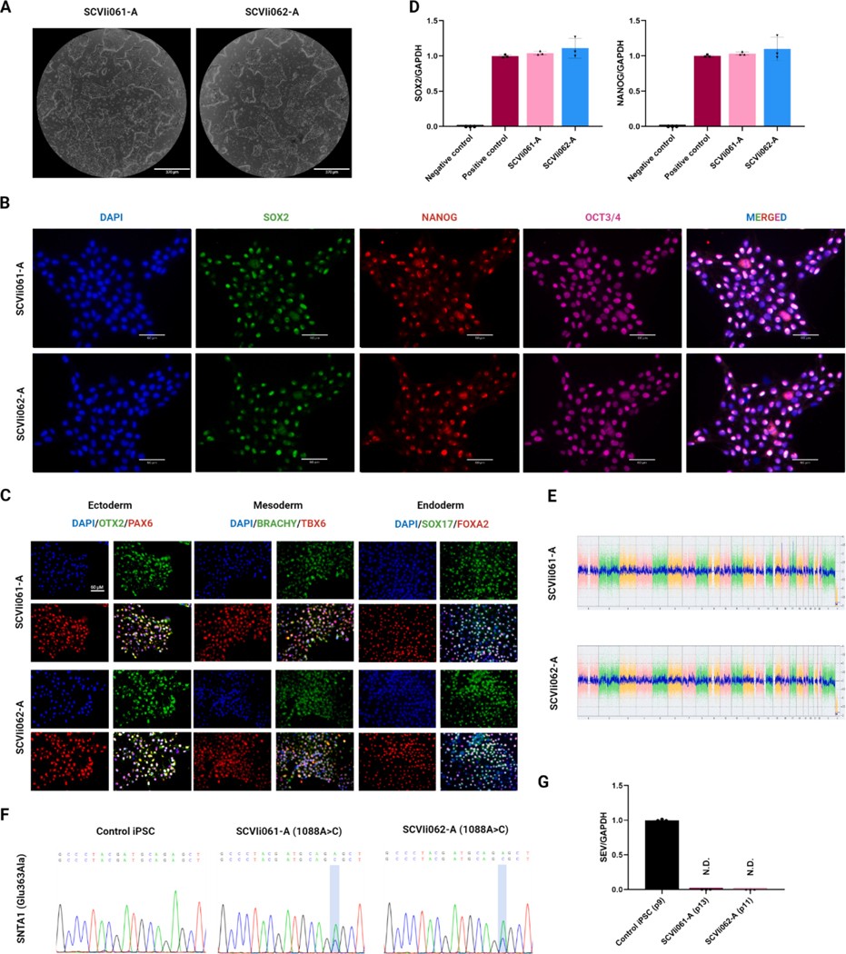 Characterization of iPSC lines derived from two long QT patients carrying an SNTA1 mutation