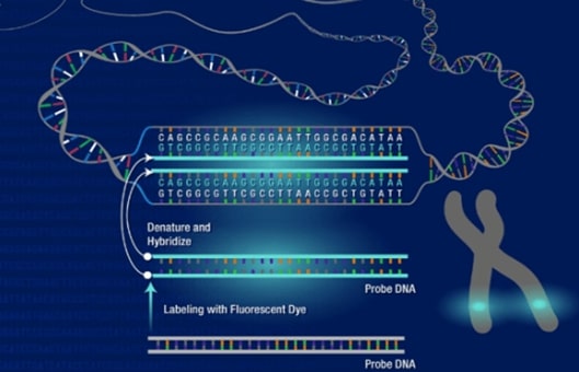 Molecular Karyotyping (aCGH) Service