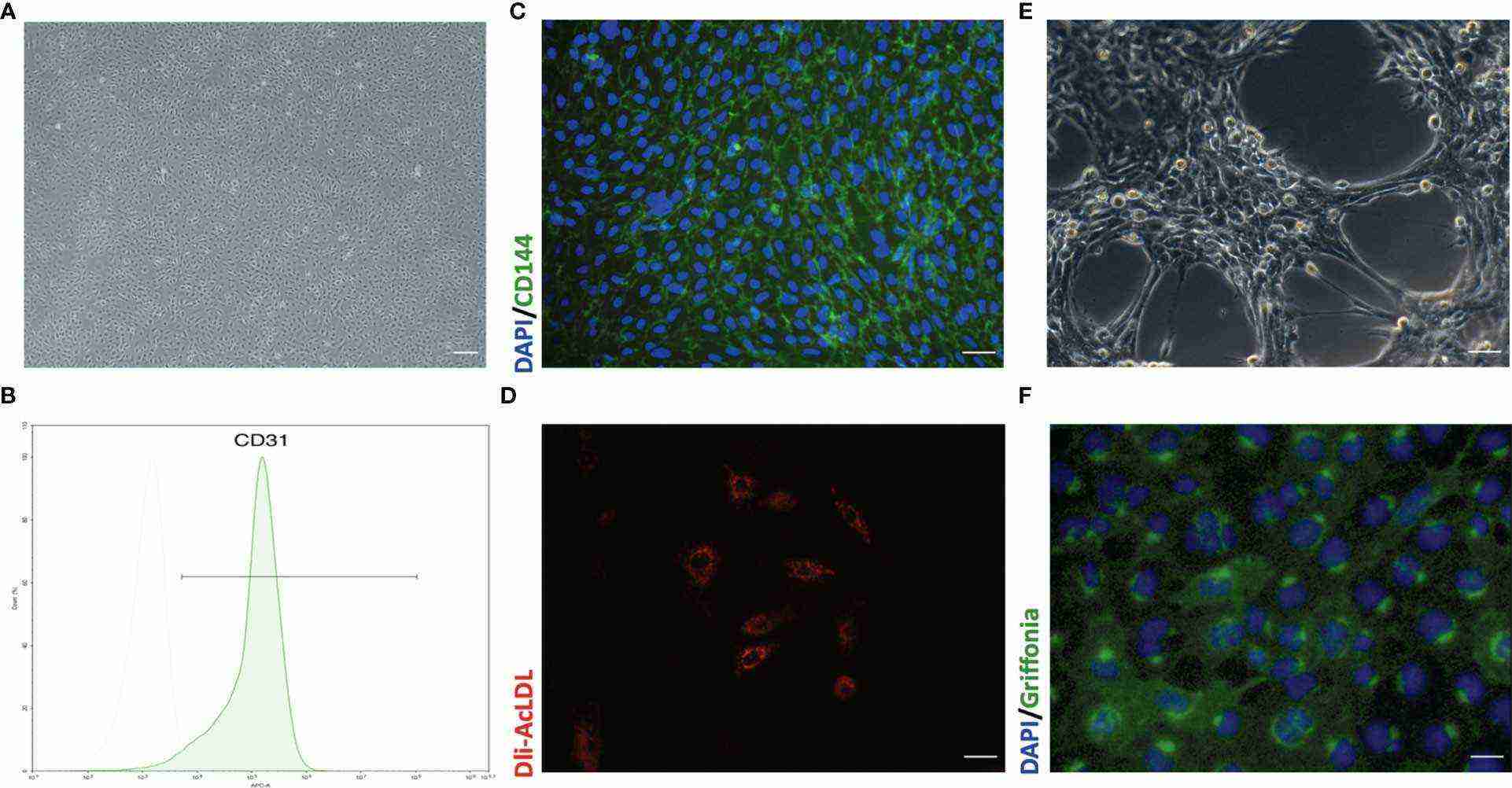 Typical morphology and characterization of primary mouse lung microvascular endothelial cells.