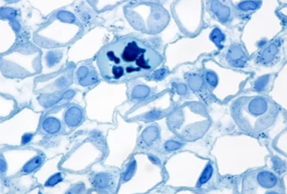 comparison-of-membrane-stains-vs.-cell-surface-stains