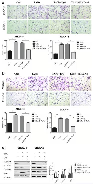 (a, b) The effect of neutrophils on the migration and invasion ability of GC cells (MKN45 and MKN74) was determined 24 h when IL-17a neutralizing antibody or IgG isotype control antibody was added to Transwell co-culture chamber. c Protein expression of E-cadherin, Vimentin, and ZEB1 in GC cells (MKN45 and MKN74) co-cultured with neutrophils were analyzed by western blot when IL-17a neutralizing antibody or IgG isotype control antibody was added to the Transwell co-culture system.