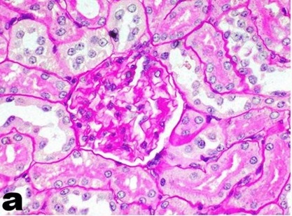 Periodic acid–Schiff staining utilized on kidney tissue samples.