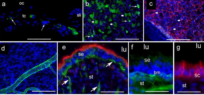 Immunofluorescence (IF) staining conducted on frozen tissue sections.