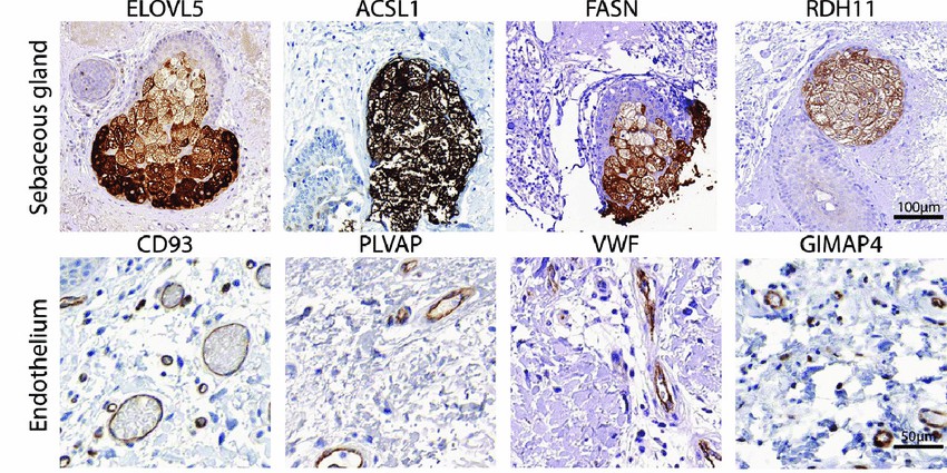 Illustrative examples of immunohistochemical staining targeting proteins encoded by SkinSig marker genes.