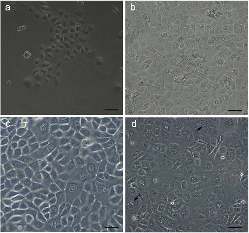 The morphological characteristics of keratinocytes derived from foreskin (a: passage 0; b: passage 3; c: passage 5, d: passage 7).