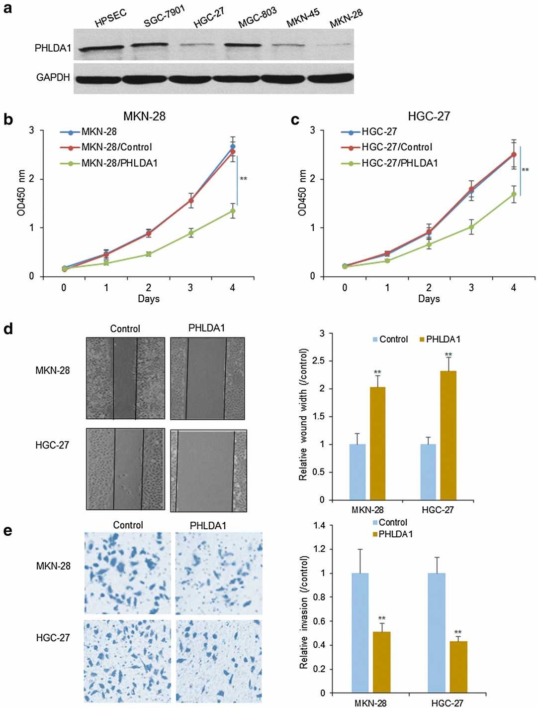 PHLDA1 reduces the survival and spread of gastric cancer cells.