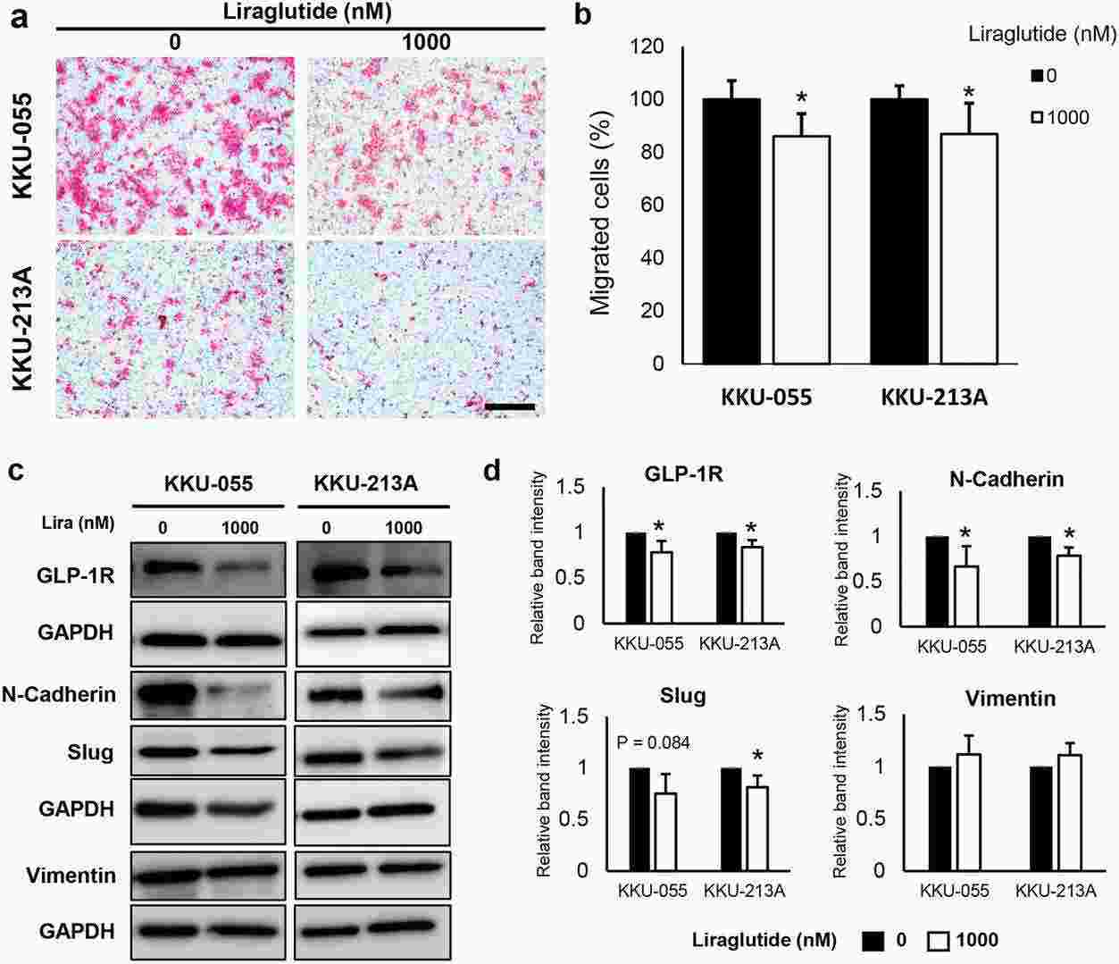 Liraglutide suppresses the migration of CCA cells by suppressing the expression of GLP-1R and EMT markers.