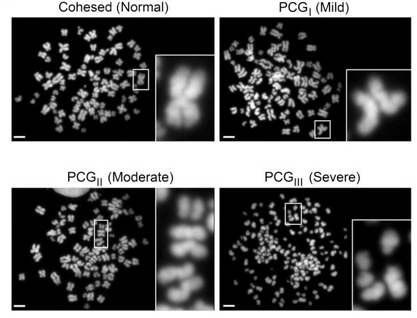 Representative images of mitotic chromosome spreads from the L-540 cells. (Sajesh BV, et al., 2013)