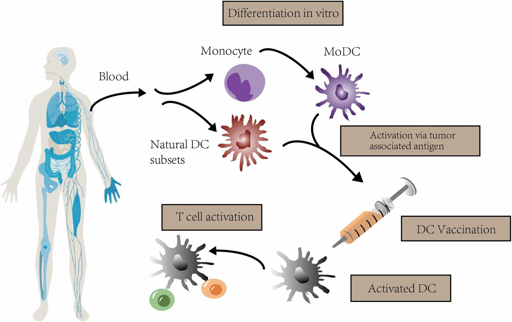 The concept of DC vaccination. In clinical trials, autologous monocytes are commonly used as the source of DC vaccines, with differentiation and maturation occurring in vit.