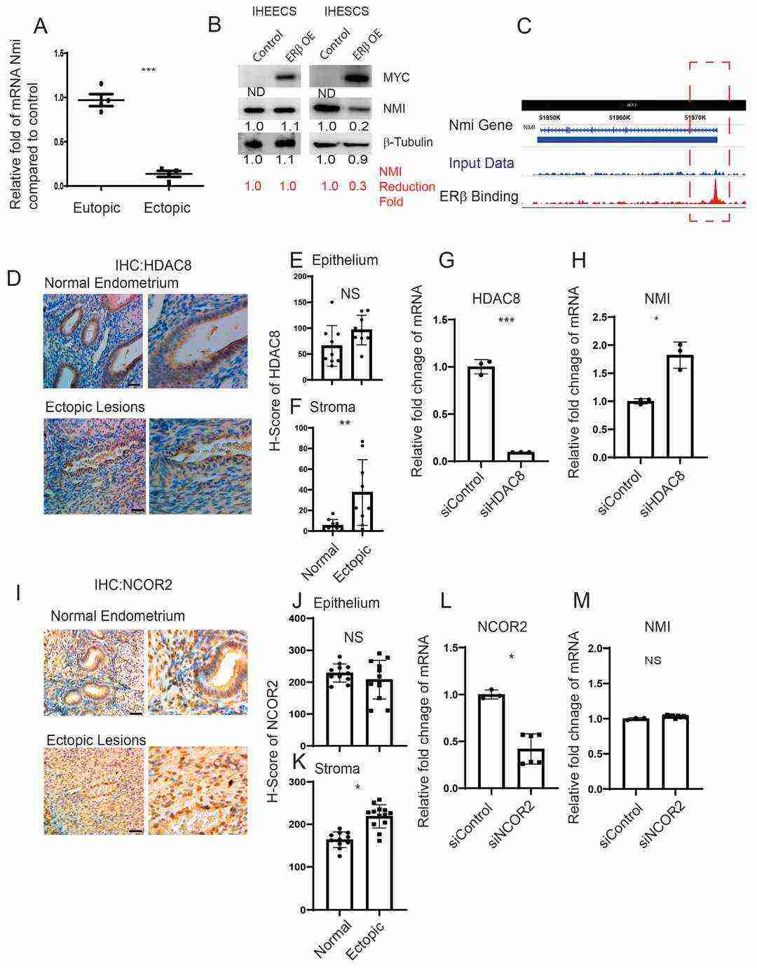 Regulation of NMI expression through the ERβ/HDAC8 pathway in endometrial stromal cells.