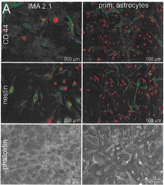 IMA 2.1 and primary mouse astrocytes were examined for their traits. They were stained for CD44 and nestin (in green) and their nuclei were marked with H-33342 (in red). Phalloidin was used to highlight cell shape by targeting F-actin. 