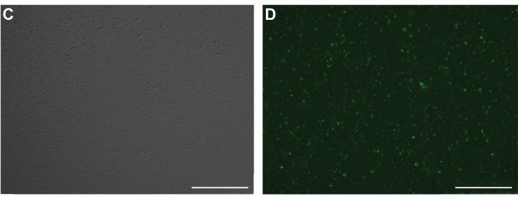 Expression of IGF-IR (left) and IGF-I (right) mRNA in LP-1, EJM, and Karpas 707. (Georgii-Hemming P, et al., 1996)