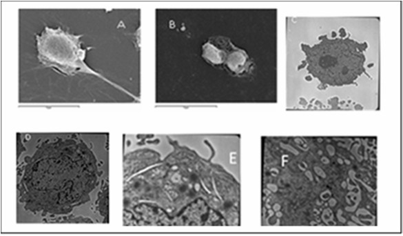 Ultrastructural morphology of RPMI 7932 cells examined using electron microscopy.