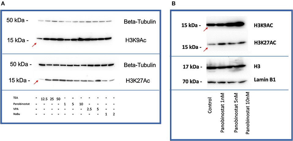 HDACi potently enhances acetylation of H3K9 and H3K27 histones in CEF.