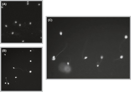 TUNEL (Terminal deoxynucleotidyl transferase-mediated dUTP Nick-End Labeling) assay.