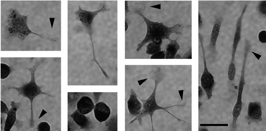 Photomicrographs with high magnification display SIM-A9 cells exhibiting various morphologies characteristic of microglia.