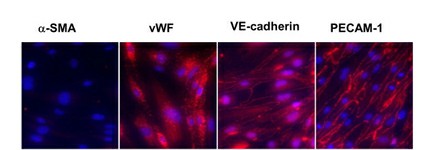 Immunostaining is used to characterize iMAEC-WT lines.