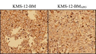 Immunocytochemistry staining of Fas expression in APO010-resistant cell lines.