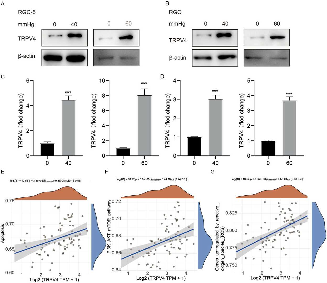 TRPV4 expression levels are noted in RGCs within the glaucoma model.