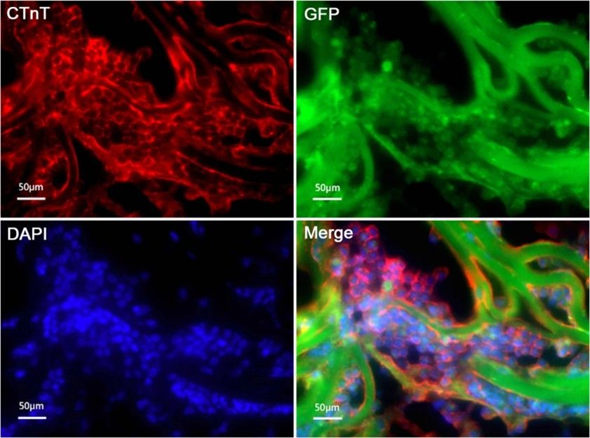 cTnT expression of mouse adipose-derived mesenchymal stem cells induced 3 weeks with 5-aza on 3D scaffolds by immunofluorescence staining
