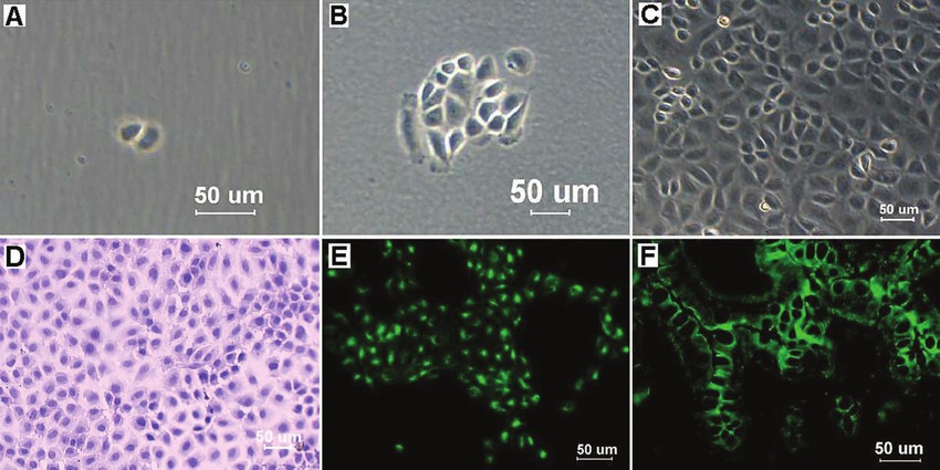 Generation of cell clones and morphological characterization of mouse intestinal epithelial cells (IECs).