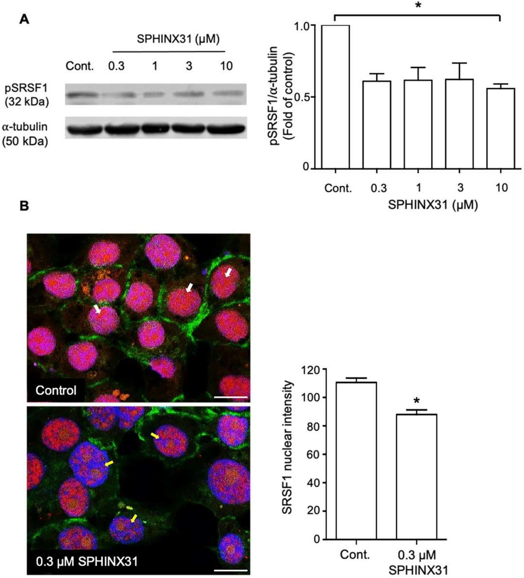 Influence of SPHINX31 on SRSF1 phosphorylation and nuclear localization in HuCCA-1 cells.
