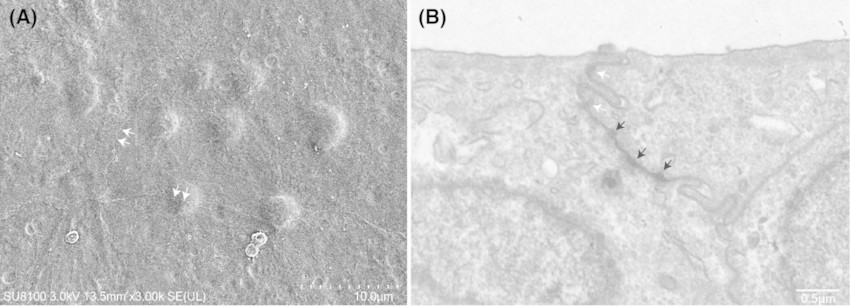 Electron microscopy images of SV-40 immortalized human urothelial cells.
