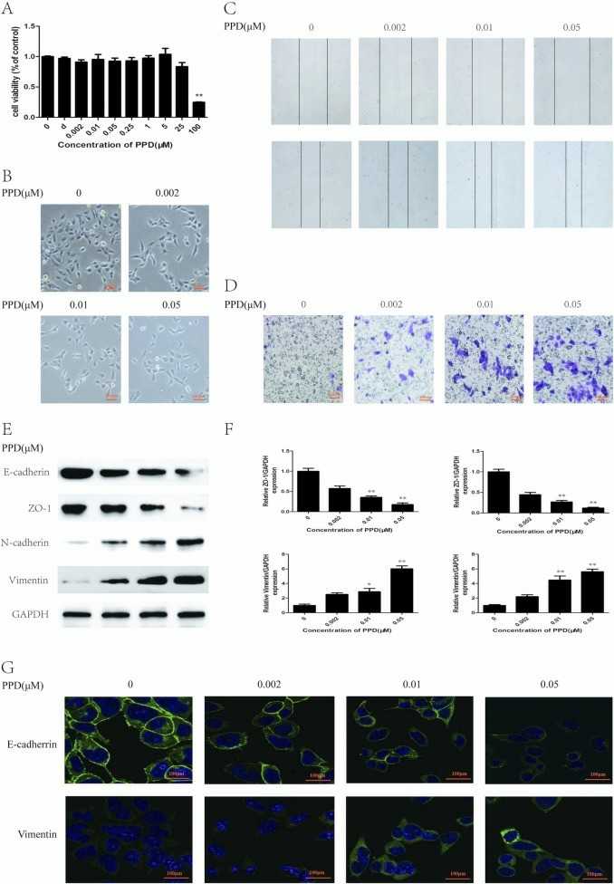 PPD induces EMT in SV-40 immortalized human urothelial cells.