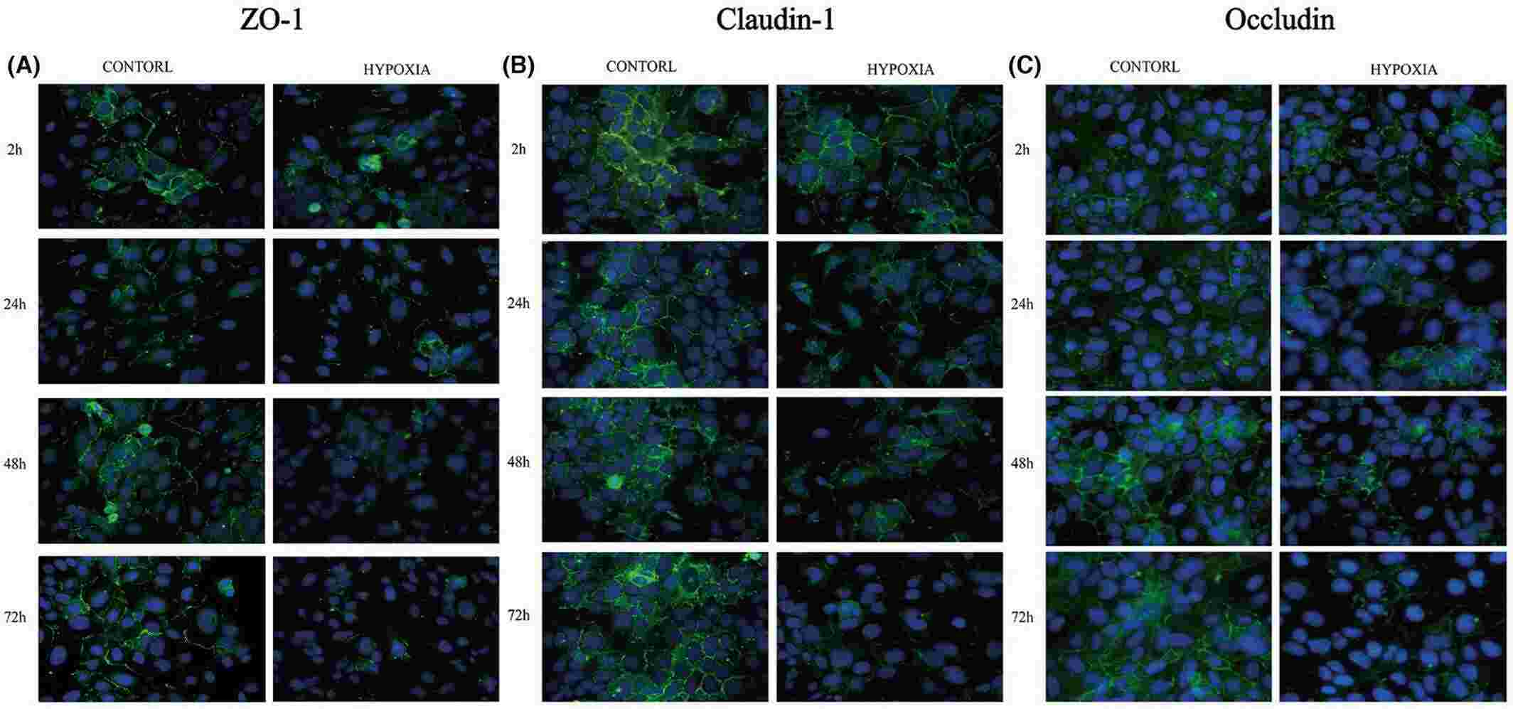 Immunofluorescent staining of ZO-1, claudin-1 and occludin proteins under hypoxia exposure.